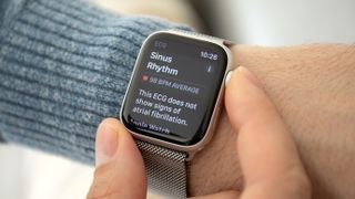 Apple Watch EKG - sinüs ritmi