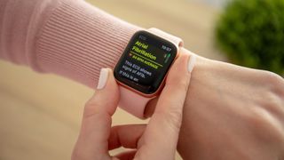 Apple Watch EKG - atriyal fibrilasyon